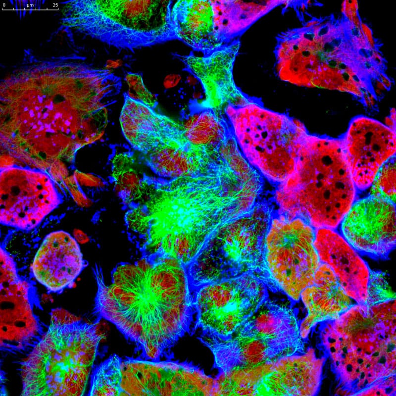 Using statistical modelling to understand cell heterogeneity