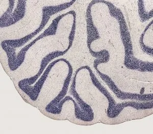 selenoproteins