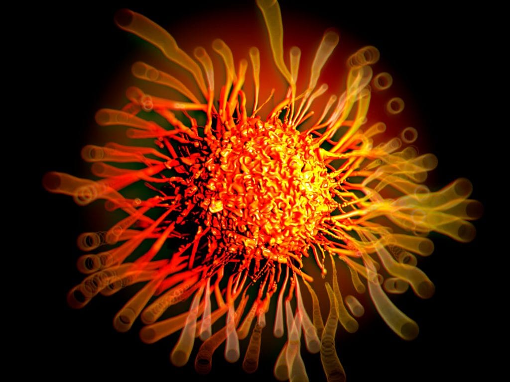 Medulloblastoma