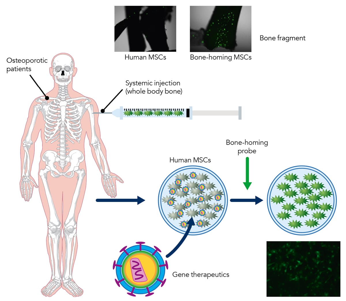 Novel therapeutics to promote bone formation in skeletal diseases