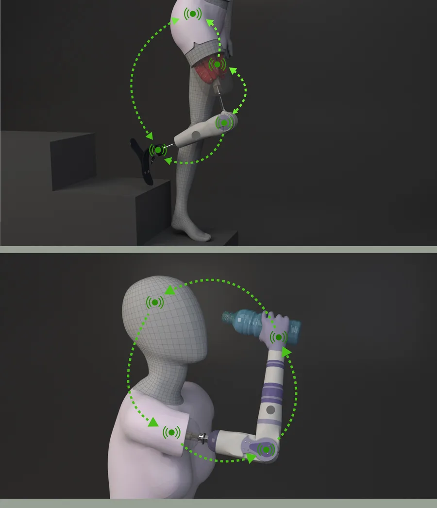 Bionic Arm Anime