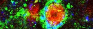 How opioids drive our salt consumption
