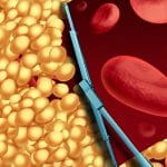 High-dose Niacin is a promising treatment for Non-Alcoholic Fatty ...