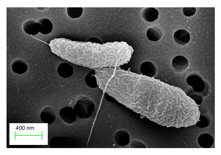 novel-detection-methods-for-dormant-bacteria-in-seafood