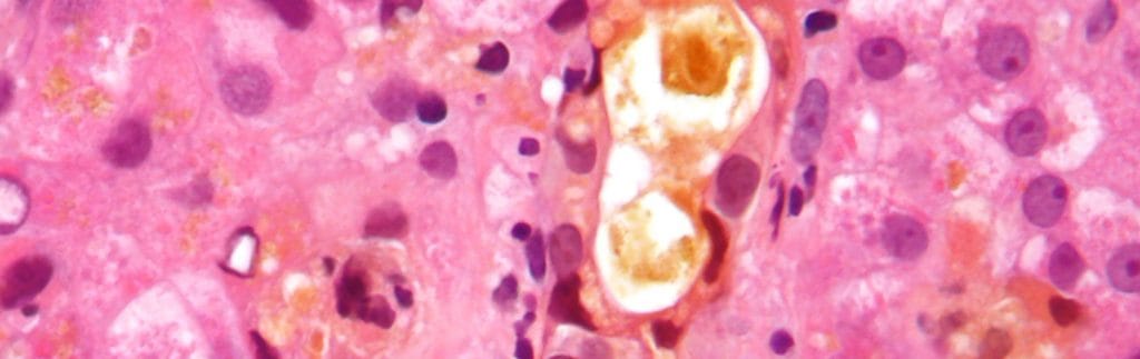 bile acid through a microscope