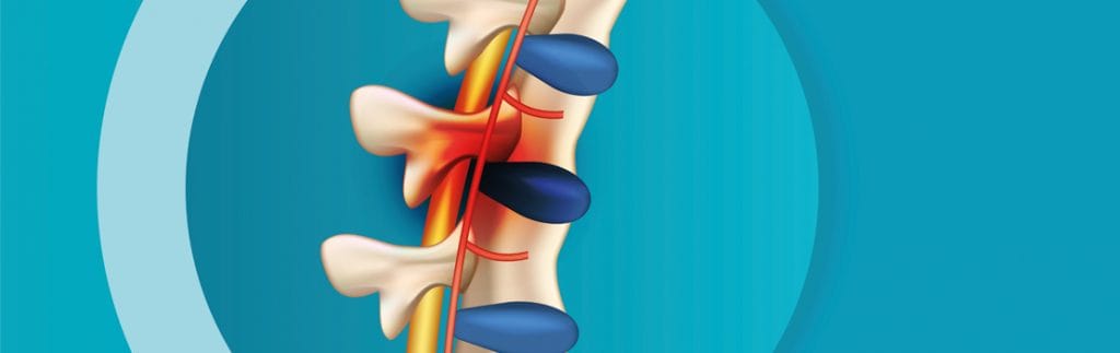 Researchers at UCLA have conducted a study on rats to test the efficacy of non-invasive electrical stimulation and pharmaceutical interventions using seratonin drugs to rebuild motor function in the upper body after a cervical spinal injury