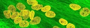 The Translational Genomics Group investigate innovative therapies for Myotonic dystrophy type 1, including miRNA therapies