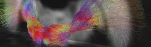 Alice Witney tests the viability of using diffusion magnetic resonance imaging (dMRI) on locusts for improving insect neurobiology.